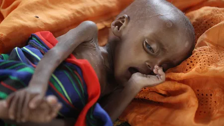 UNICEF: Cinci din şase copii sub doi ani sunt subnutriţi, cu risc ireversibil pentru sănătate