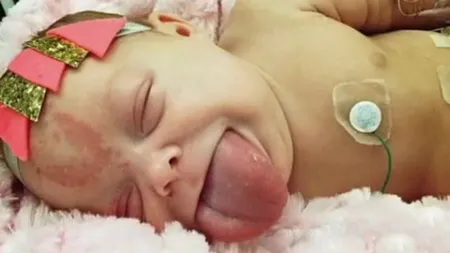 Era fericită că va aduce pe lume o fetiţă, dar când a văzut-o în sala de naşteri, mama a început să ţipe de groază