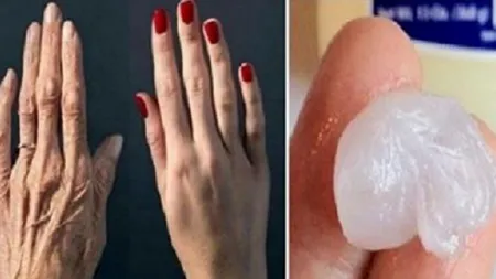 Şi-a dat cu asta pe mâini şi au început să arate cu 20 de ani mai tinere! Reţeta secretă pe care trebuie să o încerci