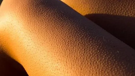 De ce ni se face pielea de găină când ne este frig