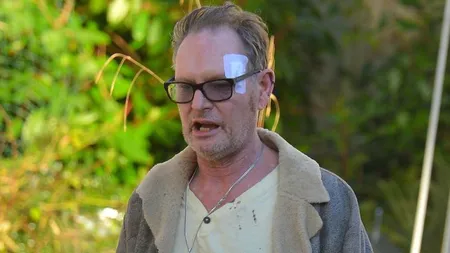 Paul Gascoigne, bătaie în club. S-a ales cu craniul fracturat, cu 11 copci