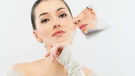 Produsul cosmetic pe care NU trebuie să îl aplici pe zgârieturi