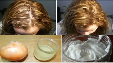 Remediul incredibil care îţi îndeseşte părul într-o singură săptămână!