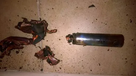 Imagine de groază, i-a explodat ţigara electronică în gură. A pierdut şapte dinţi, iar faţa îi e tumefiată FOTO