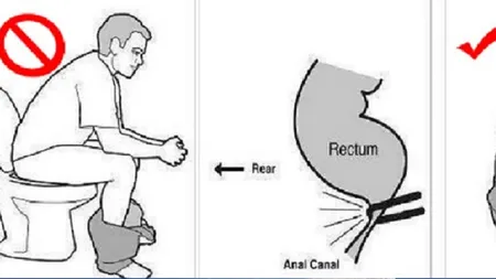 Ai folosit toaleta GREŞIT toată viaţa. Uite cum spun medicii că trebuie să stai la WC