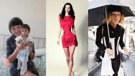 Chinezoaica de trei ani şi doar 2,5 kilograme
