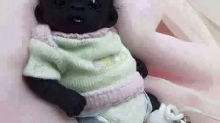 Cel mai negru copil din lume a crescut şi s-a transformat destul de mult. Cum arată acum FOTO