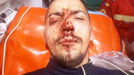Taximetrist snopit în bătaie de patron la Focşani VIDEO