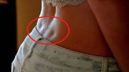 Ai aceste adâncituri în spate? Eşti o persoană specială! Uite ce spun despre tine!