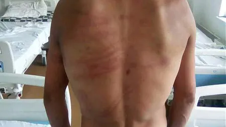 Un tânăr susţine că a fost bătut de 2 poliţişti din comuna COPĂLĂU. Acesta are 10 copci la gură şi este plin de vânătăi FOTO