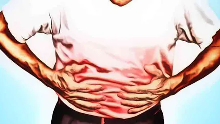 Cancerul stomacal, UCIGAŞUL SILENŢIOS. Care sunt semnele şi cum poate fi prevenită groznica boală