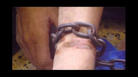 Un băiat de 14 ani acuză paznicul unui iaz că l-a bătut cu lanţul în timp ce culegea ciuperci