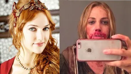 Meryem Uzerli (Sultana Hurrem), cu faţa plină de SÂNGE. Cum a ajuns să arate AŞA
