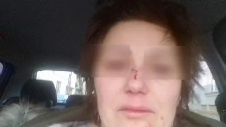 Femeie lovită pentru că a parcat greşit