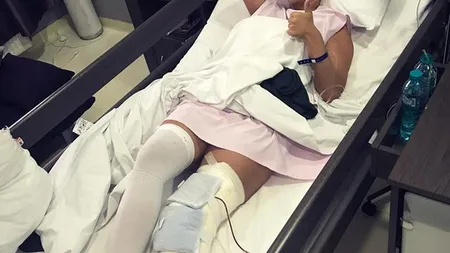Anda Adam a scăpat cu bine după operaţia la picior. Cât rămâne internată