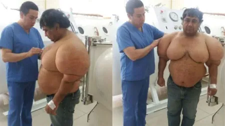 Medicii sunt uimiţi de acest om: Nici nu ştiu dacă este sănătos sau este în pericol
