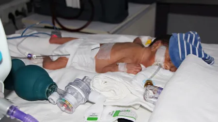 Maternitatea Filantropia din Craiova, dotată cu aparatură pentru salvarea bebeluşilor născuţi prematur