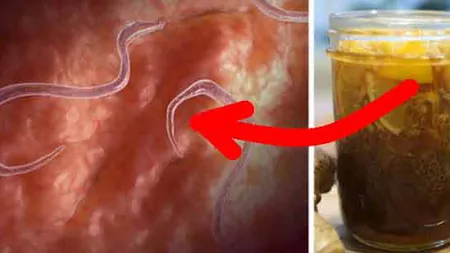 Preparatul care elimină orice infecţie şi parazit din corp. Se găseşte în orice bucătărie