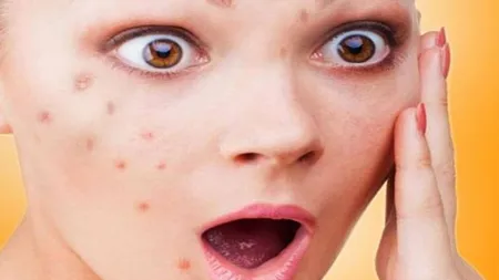 Ce produse naturale îţi distrug pielea