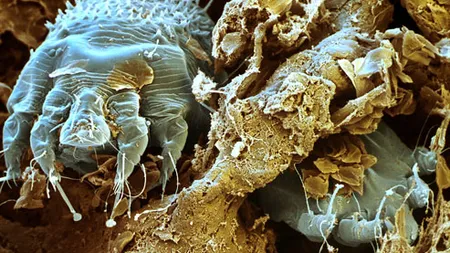 6 insecte care îţi pot strica vacanţa de 1 MAI. La ce să fii atent