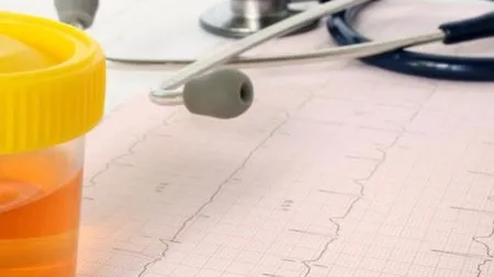 Ce provoacă creşterea nivelului de acid uric