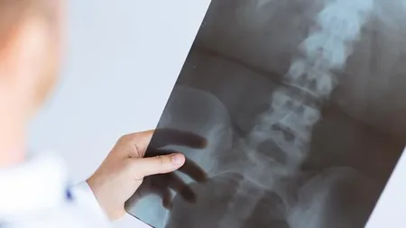 O femeie simţea ceva BIZAR în picioarele sale, iar doctorii au rămas ŞOCAŢI când au văzut ce 
