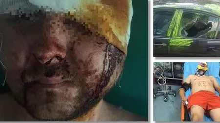 Imagini şocante! Un bărbat de 34 de ani, bătut cu bestialitate, în mijlocul zilei. Atacatorul se temea că vrea să-i fure nevasta