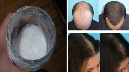 Îţi cade părul? Scapă de problemă cu un ingredient din bucătărie. Este nevoie de doar trei linguriţe