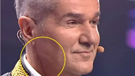 Dan Bittman, dezvăluiri crunte despre operaţie. 