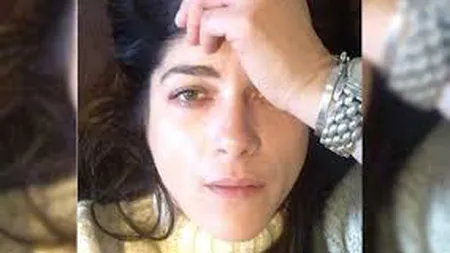 Şoc în showbiz! Actriţa a dezvăluit că suferă de o boală cruntă la doar 46 de ani. Mesajul sfâşietor postat pe Instagram