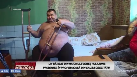 Cel mai gras moldovean a ajuns să cântărească un sfert de tonă. Sergiu Pânzari are 34 de ani şi n-a mai ieşit din casă de un an FOTO