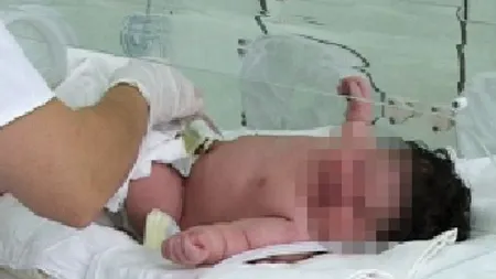Bebeluş gigant născut la maternitatea din Botoşani