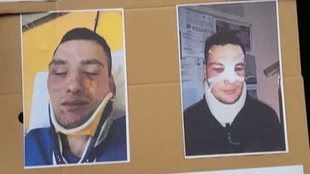 Primele imagini cu poliţistul bătut de patronul unei pensiunui din Harghita