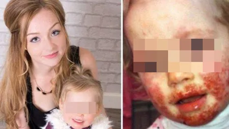 Caz şocant de sărut al morţii! A fost la un pas să piară, după un pupic nevinovat: Mamelor, nu mai permiteți să vi se pupe copilașii