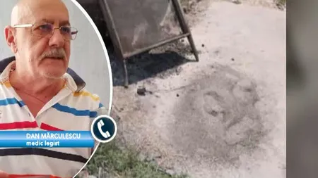Medicul legist Dan Mărculescu face lumină în cazul contraexpertizei ADN cerute de Alexandru Cumpănaşu VIDEO