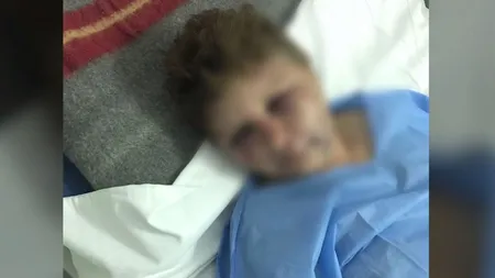 Femeie bătută cu sălbăticie de un poliţist, în Olt. Omul legii a încercat să o şi violeze. 