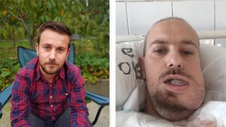 A MURIT tânărul chinuit de o TUMORĂ URIAŞĂ. Peste 11.000 de români AU DONAT bani pentru A-L SALVA