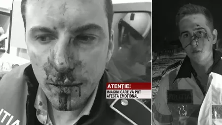 Unul dintre poliţiştii bătuţi de rudele unui suspect, în Vâlcea, transferat la un spital din Bucureşti pentru a fi operat