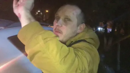 Detalii-bombă din scandalul în care a fost implicat cântăreţul What's UP. De unde provin vânătăile pe care le are artistul