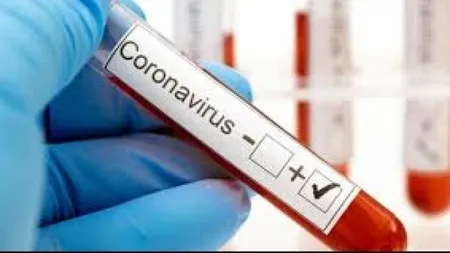 Ministerul Sănătăţii, anunţ de ultimă oră despre pericolul de a rămâne fără teste de diagnosticare a coronavirusului