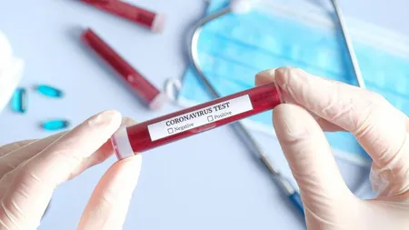 BILANŢ CORONAVIRUS ROMÂNIA. Numărul persoanelor infectate cu COVID-19 a ajuns la 5.467. La ATI sunt internaţi 183 pacienţi