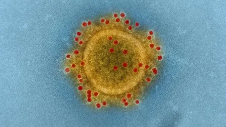 COVID-19. Un sfert dintre cei infectaţi în focarul epidemiei din Franţa au dezvoltat deja anticorpi împotriva virusului