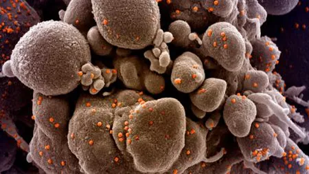 Cercetătorii americani au dat publicului imagini cu o celulă umană atacată de Coronavirus FOTO