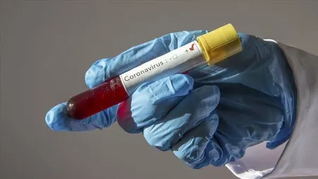 Cercetătorii israelieni au găsit o metodă pentru a depista de la distantă coronavirusul