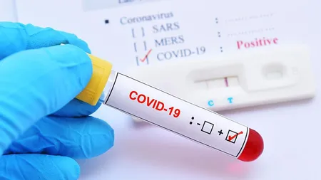 BILANŢ COVID-19 la 12 iulie în România. 456 de cazuri noi de coronavirus. 243 de pacienţi sunt la Terapie Intensivă