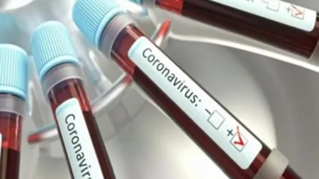 FOCAR de coronavirus la o fermă din Germania. 151 de angajaţi români, confirmaţi cu COVID