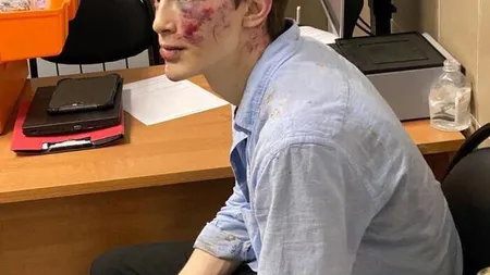 Jurnalist rus, atacat la Moscova şi rănit grav la cap. Este cunoscut pentru criticile la adresa lui Vladimir Putin