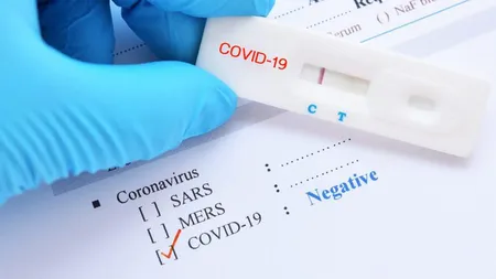 Ingeniozitate tipic românească! Cum reuşesc românii care au nevoie de teste negative să călătorească în străinătate să le facă gratis