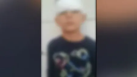 Copil de 6 ani, desfigurat la şcoală. Mai mulţi elevi au aruncat o bancă peste el