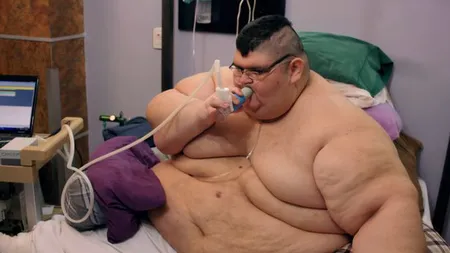 Cel mai gras om din lume s-a vindecat de COVID-19. Ajunsese la 595 KG şi suferea de multiple COMORBIDITĂŢI